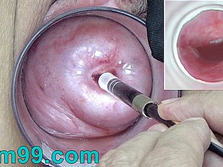 Japanische Endoskop-Kamera innerhalb Cervix Cam approximately Vagina